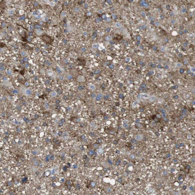 PTPRZ Antibody in Immunohistochemistry (IHC)