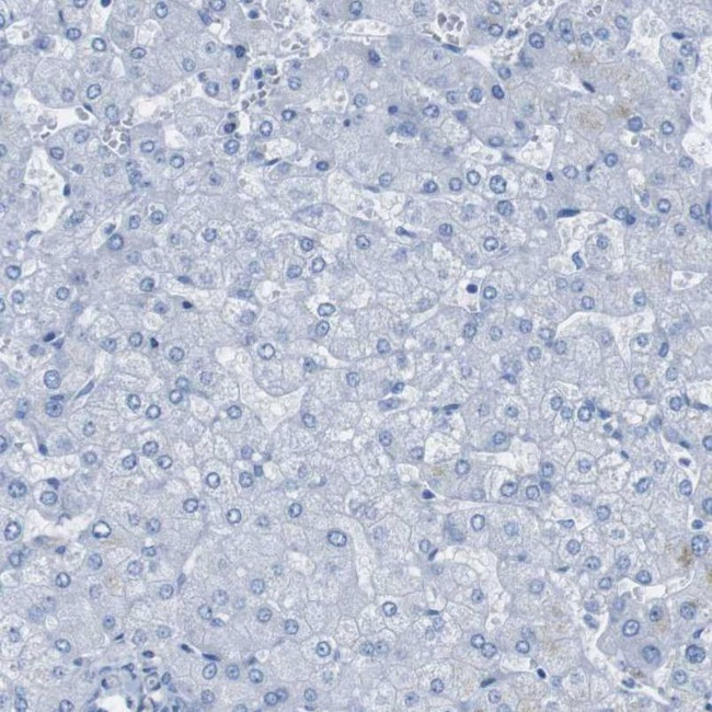 PTPRZ Antibody in Immunohistochemistry (IHC)