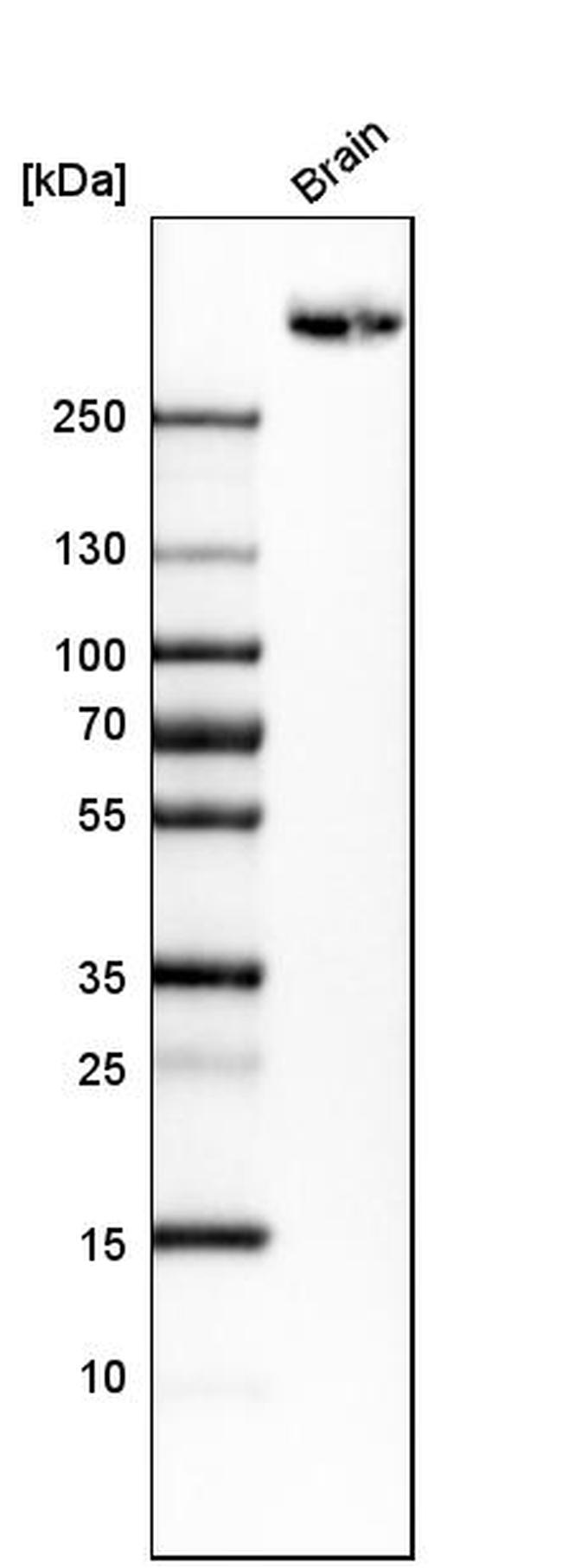 PTPRZ Antibody in Western Blot (WB)