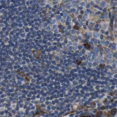 UGGT1 Antibody in Immunohistochemistry (IHC)