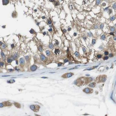 UGGT1 Antibody in Immunohistochemistry (IHC)