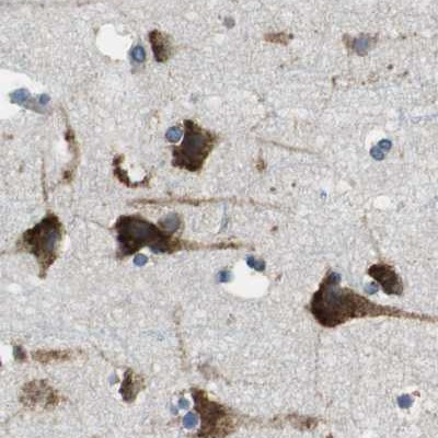 UGGT1 Antibody in Immunohistochemistry (IHC)