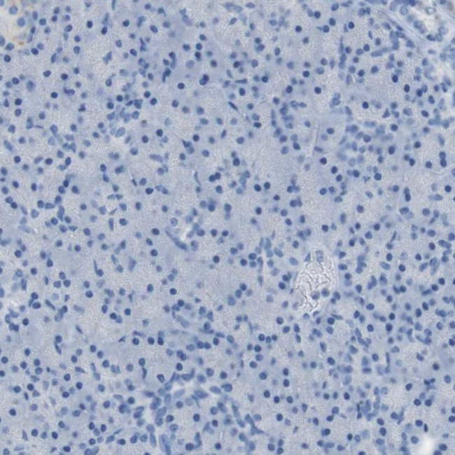 B4GALNT1 Antibody in Immunohistochemistry (IHC)