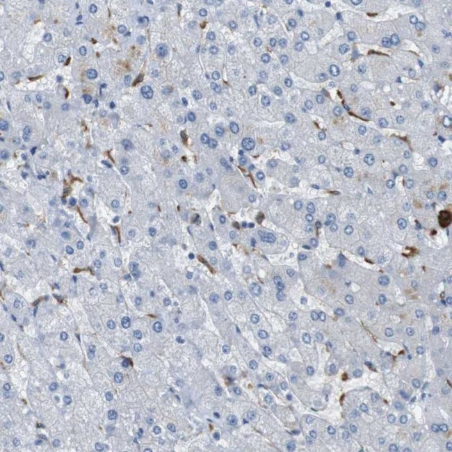 FCGRT Antibody in Immunohistochemistry (IHC)