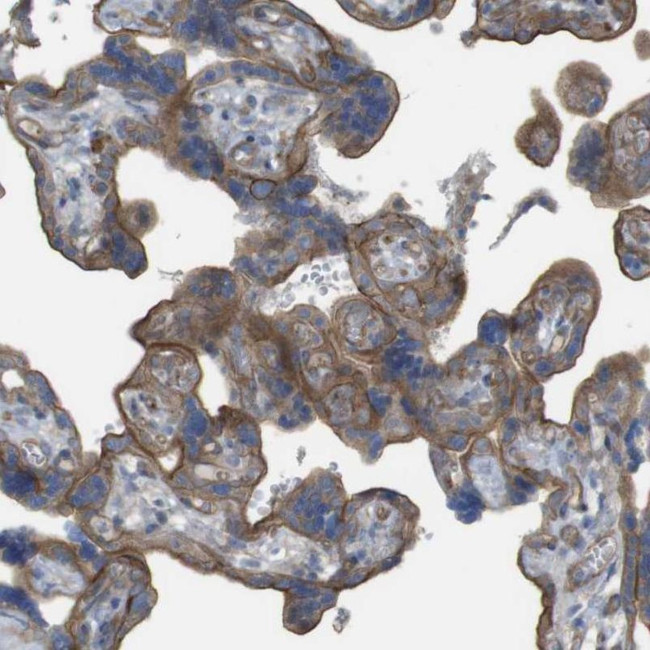 PREX2 Antibody in Immunohistochemistry (IHC)