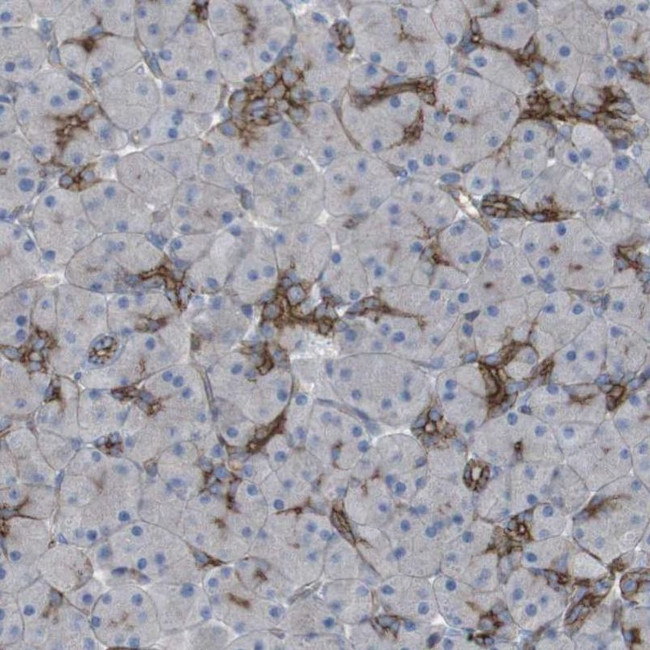 PREX2 Antibody in Immunohistochemistry (IHC)