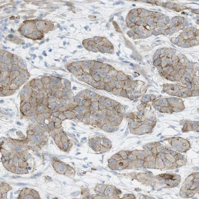 PREX2 Antibody in Immunohistochemistry (IHC)