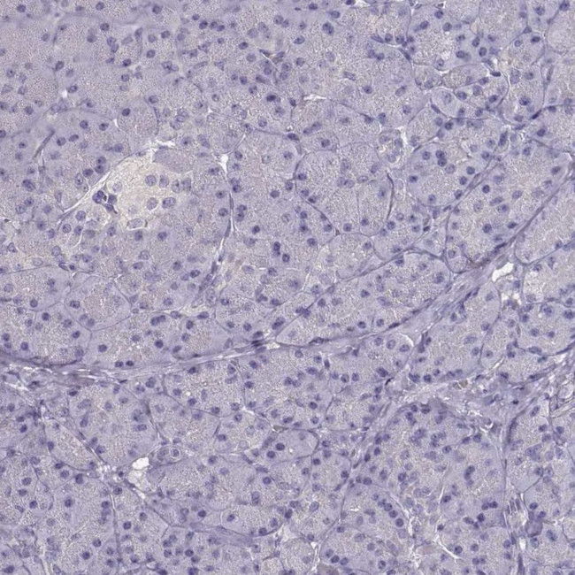 NDRG4 Antibody in Immunohistochemistry (IHC)