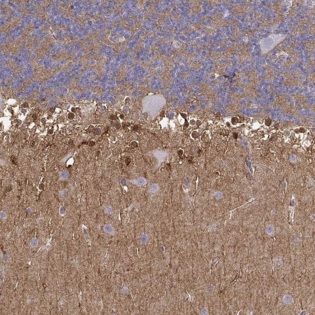 NDRG4 Antibody in Immunohistochemistry (IHC)