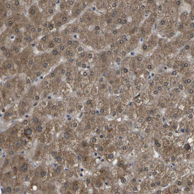 HADHA Antibody in Immunohistochemistry (IHC)