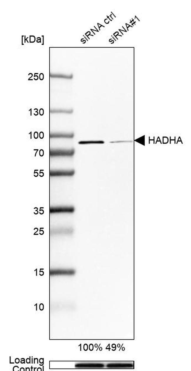 HADHA Antibody in Western Blot (WB)