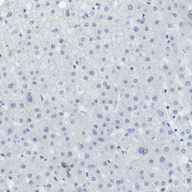 WNK2 Antibody in Immunohistochemistry (IHC)