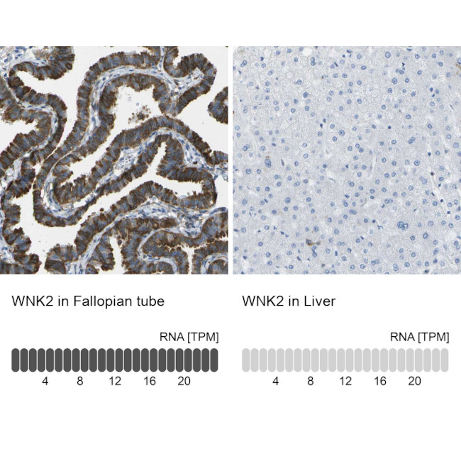 WNK2 Antibody