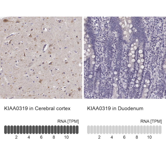 Kiaa0319 Antibody in Immunohistochemistry (IHC)