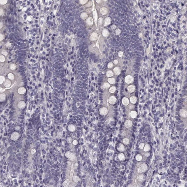 Kiaa0319 Antibody in Immunohistochemistry (IHC)