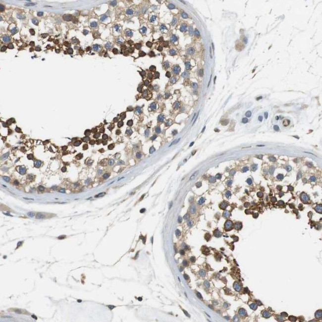 Bif1 Antibody in Immunohistochemistry (IHC)