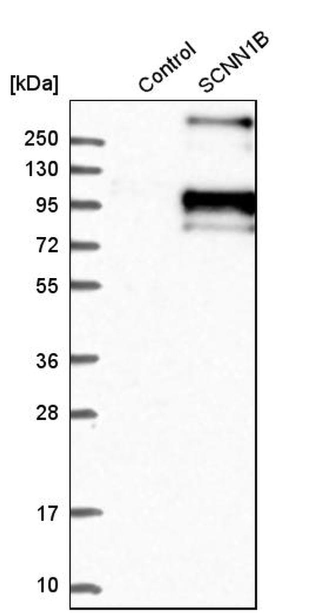 SCNN1B Antibody in Western Blot (WB)