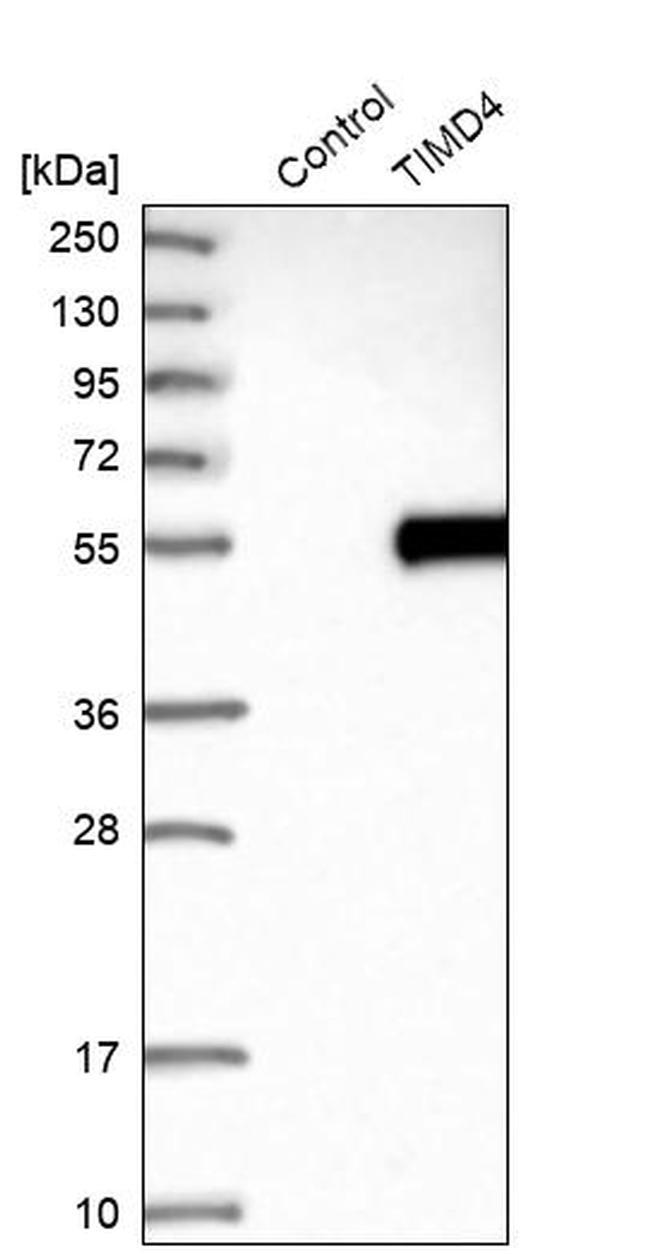 TIMD4 Antibody in Western Blot (WB)