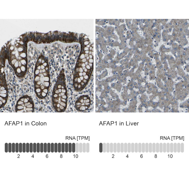 AFAP Antibody in Immunohistochemistry (IHC)