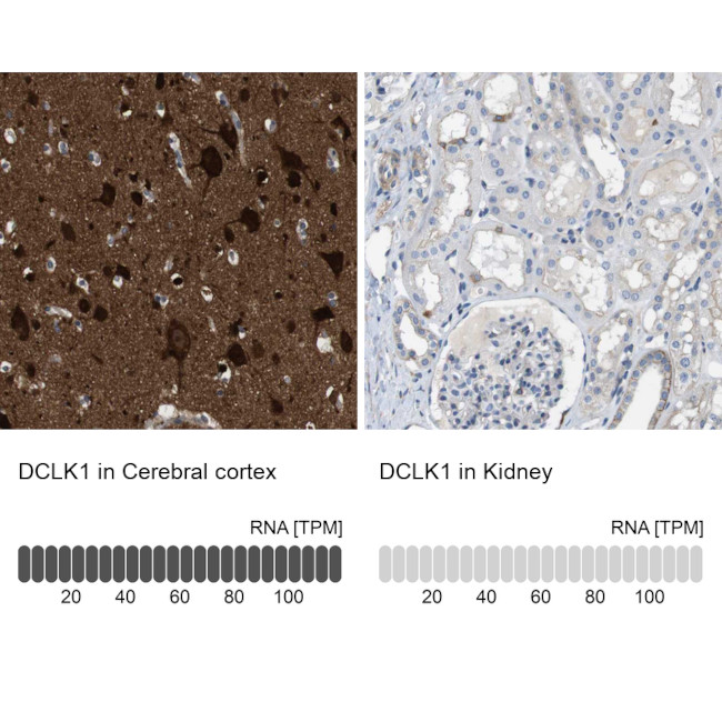 DCLK1 Antibody in Immunohistochemistry (IHC)