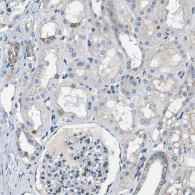 DCLK1 Antibody in Immunohistochemistry (IHC)