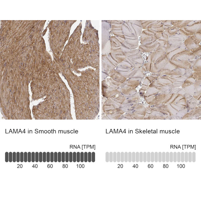 Laminin alpha-4 Antibody in Immunohistochemistry (IHC)