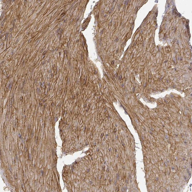 Laminin alpha-4 Antibody in Immunohistochemistry (IHC)