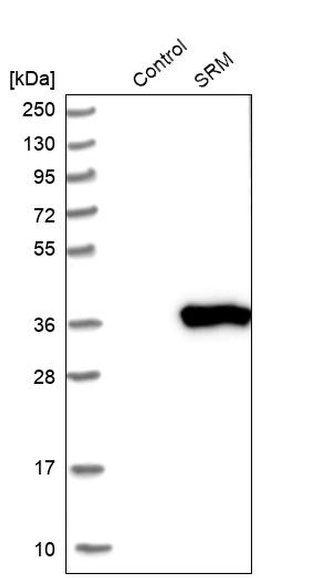 SRM Antibody in Western Blot (WB)