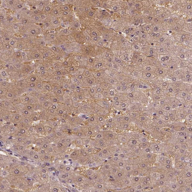 NSD2 Antibody in Immunohistochemistry (IHC)