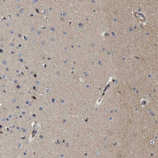 PCLO Antibody in Immunohistochemistry (IHC)