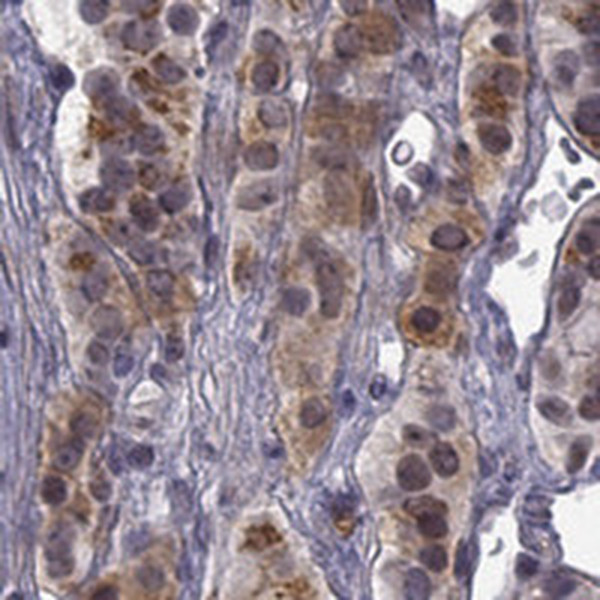 CHST8 Antibody in Immunohistochemistry (IHC)