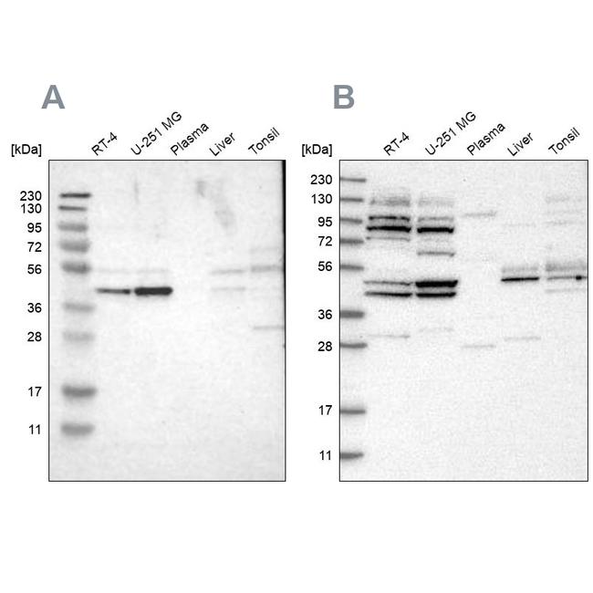 WDR53 Antibody in Western Blot (WB)