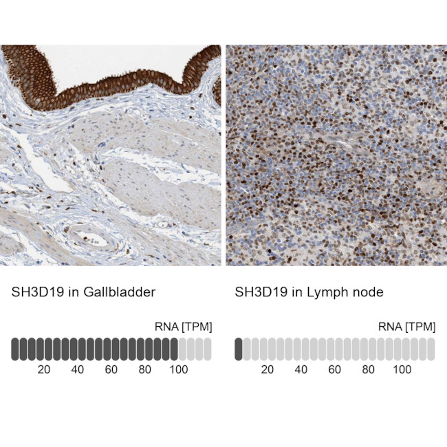 SH3D19 Antibody in Immunohistochemistry (IHC)