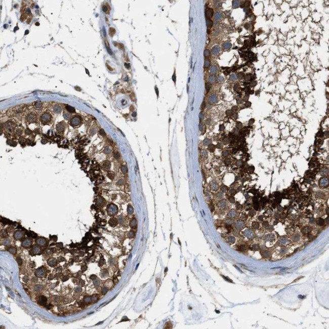 SRPK1 Antibody in Immunohistochemistry (IHC)