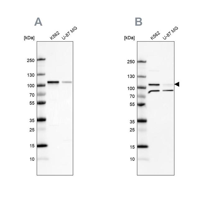 SRPK1 Antibody in Western Blot (WB)