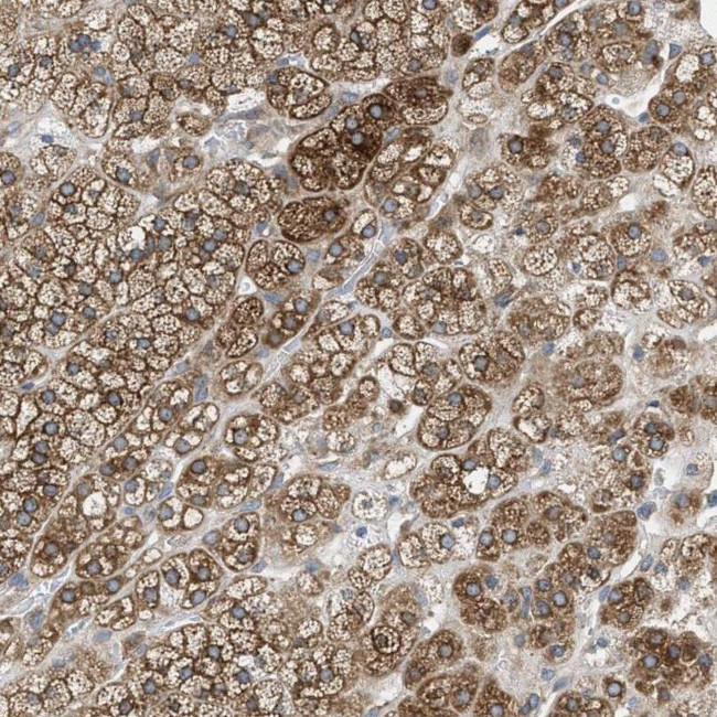 AGPAT6 Antibody in Immunohistochemistry (IHC)