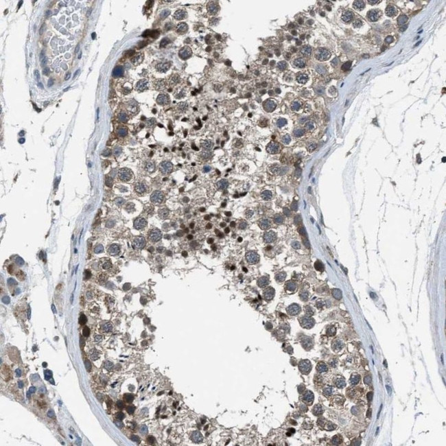 LMLN Antibody in Immunohistochemistry (IHC)