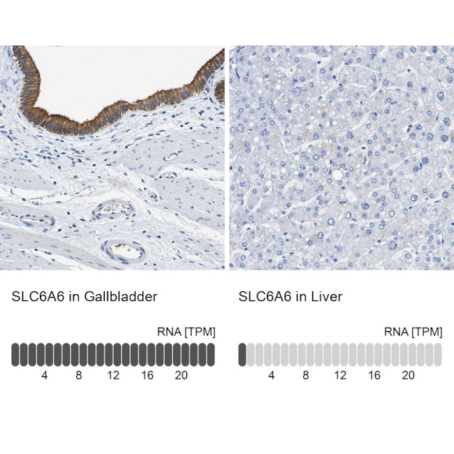 TAUT Antibody in Immunohistochemistry (IHC)