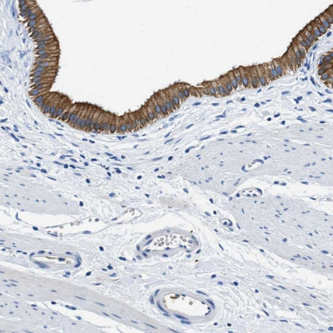 TAUT Antibody in Immunohistochemistry (IHC)