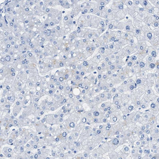 TAUT Antibody in Immunohistochemistry (IHC)