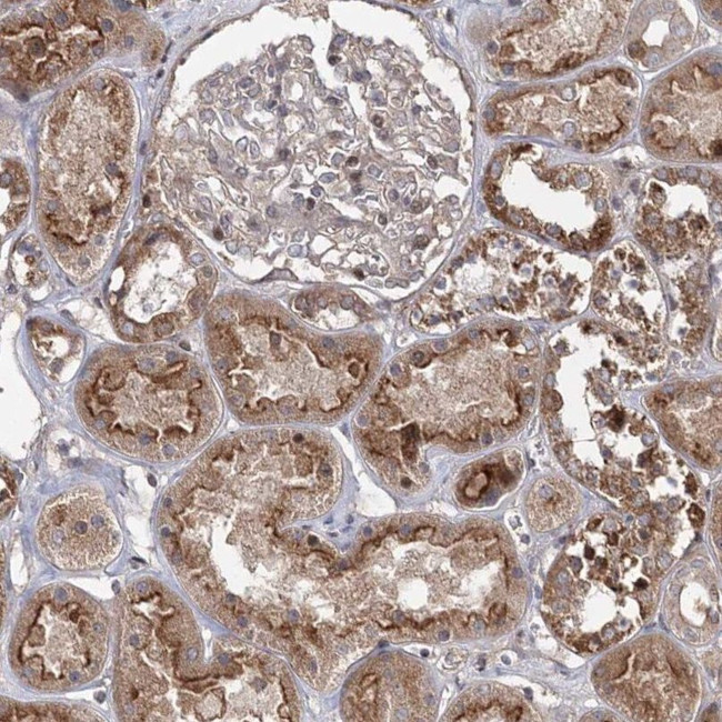 LZK Antibody in Immunohistochemistry (IHC)