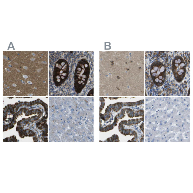 WNK2 Antibody in Immunohistochemistry (IHC)