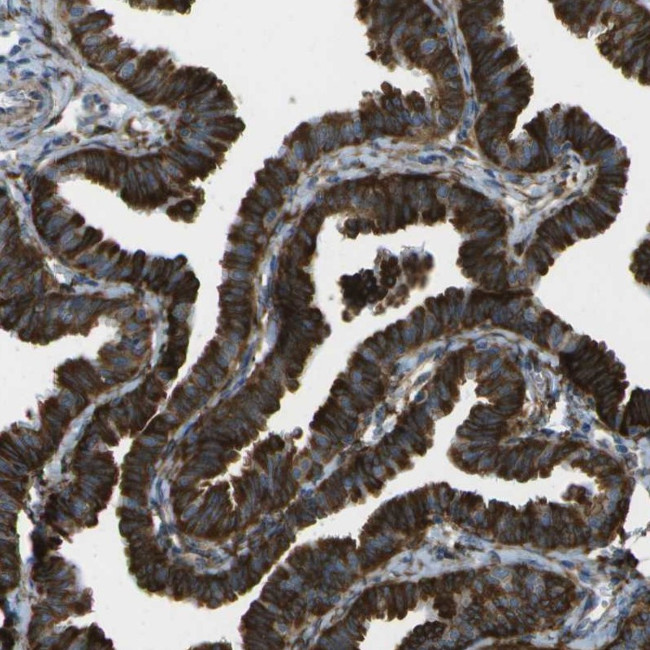 WNK2 Antibody in Immunohistochemistry (IHC)