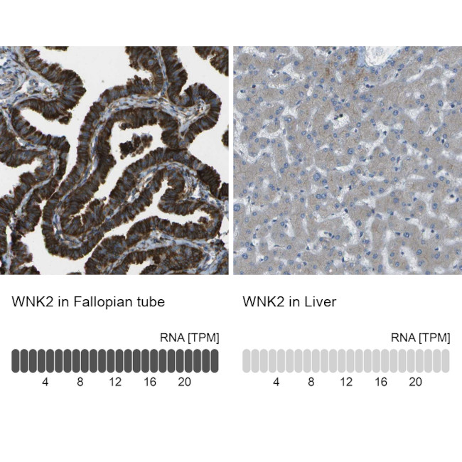 WNK2 Antibody