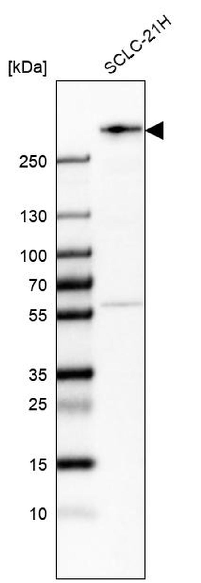 WNK2 Antibody in Western Blot (WB)