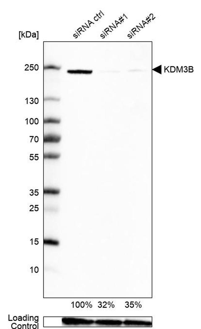 JMJD1B Antibody in Western Blot (WB)