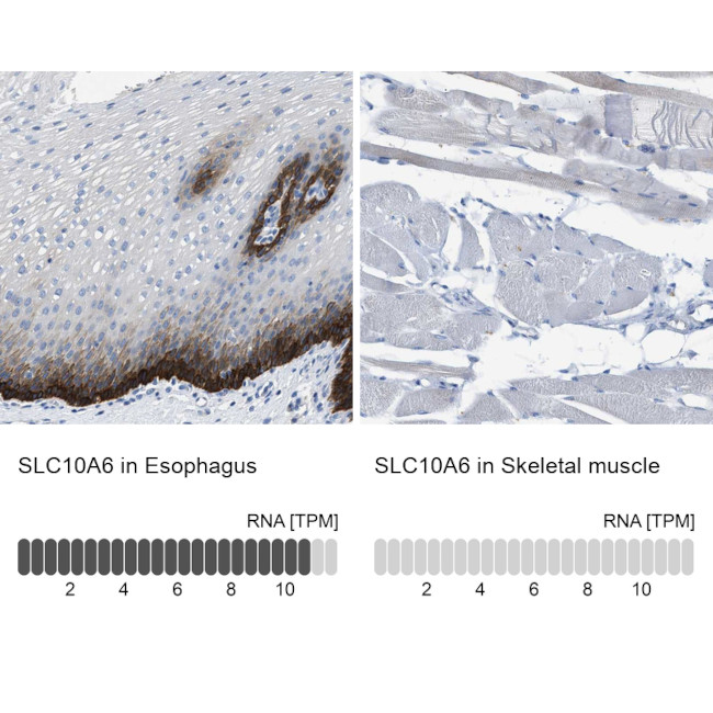 SLC10A6 Antibody in Immunohistochemistry (IHC)