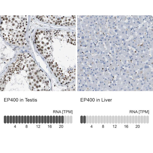 p400 Antibody