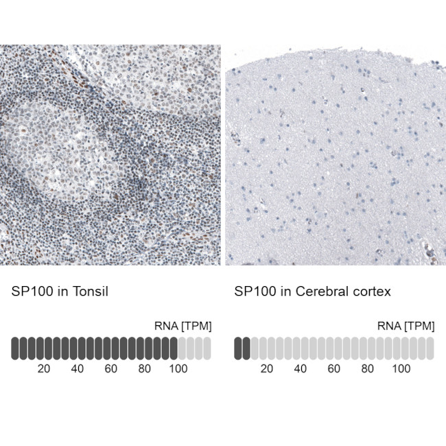 SP100 Antibody in Immunohistochemistry (IHC)