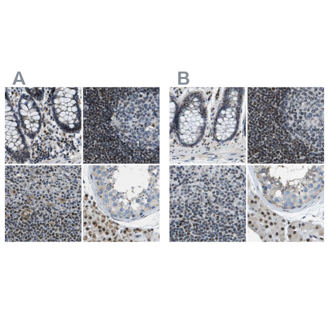 SP100 Antibody in Immunohistochemistry (IHC)